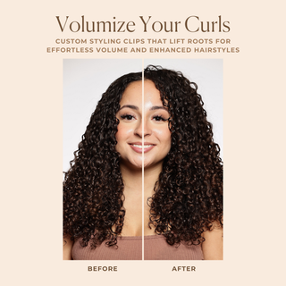 Volume Root Clips